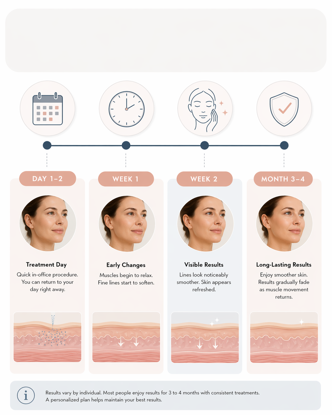 How long does botox last timeline infographic